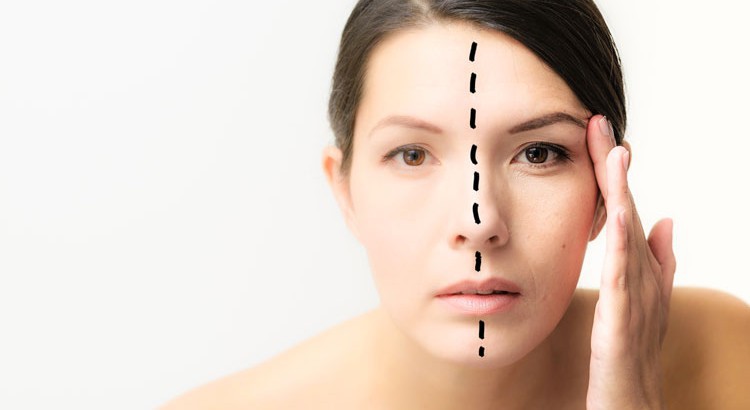 Dull skin