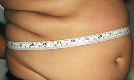 Stomach stapling
