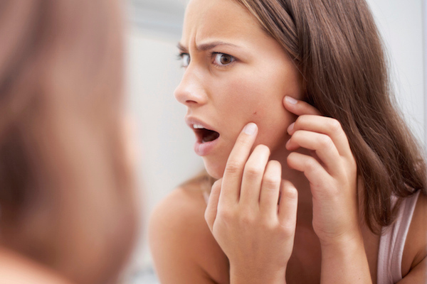 Do not pop your zits