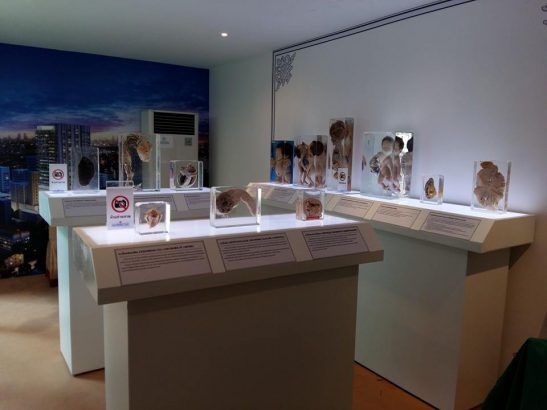 Siriraj Medical Museum, Thailand
