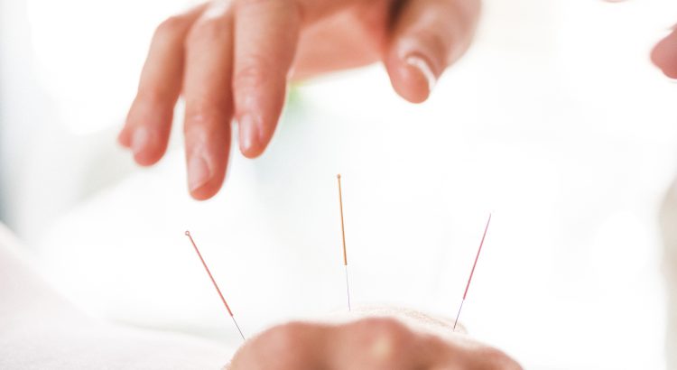 Fertility Talk: Can acupuncture boost your chances of pregnancy?