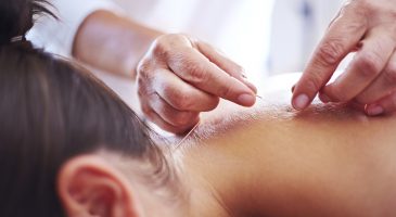 Natural Relief: Can acupuncture help your anxiety?